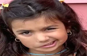 Bell’s Palsy Homeopathic treatment in Lucknow, India