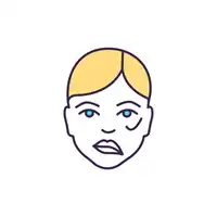 Bell’s Palsy (Facial Paralysis)