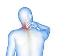Cervical Spondylosis (Neck Arthritis)