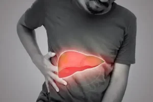 Liver Cirrhosis Homoeoparhic treatment in Lucknow, India