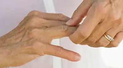 Best Finger & Small Joint Pain Homeopathic Treatment in Lucknow, India