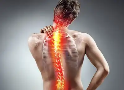 Best Spine & Neck Pain Homeopathic Treatment in Lucknow, India