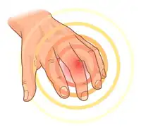 Finger & Small Joint Pain Treatment in Lucknow