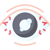 Best Glaucoma Treatment in Lucknow India