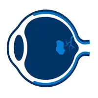 Macular Degeneration Treatment in Lucknow, India