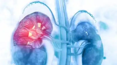 Acute Kidney Injury Homeopathic Treatment in Lucknow, India