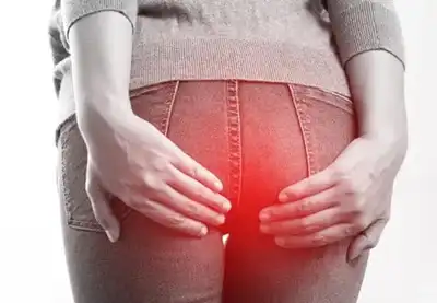 Anal Fissure Homeopathic Treatment in Lucknow, India