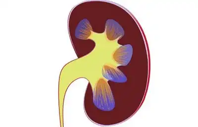 Nephrotic Syndrome Homeopathic Treatment in Lucknow India