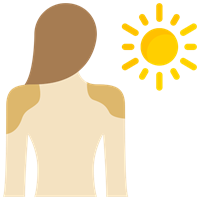 Sunburn Treatment in Lucknow, India