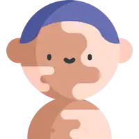 Vitiligo Treatment in Lucknow India