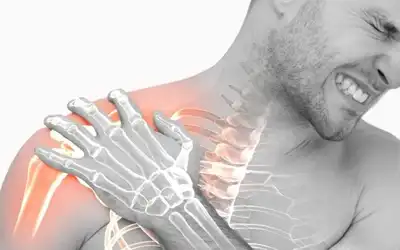 Frozen Shoulder (Adhesive Capsulitis) Homeopathic Treatment in Lucknow India