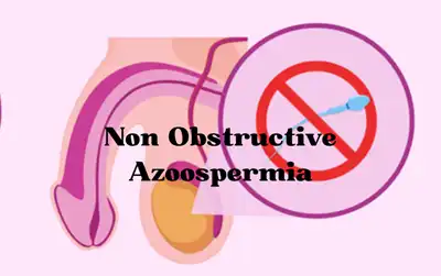 Non-Obstructive Azoospermia Homeopathic Treatment in Lucknow, India