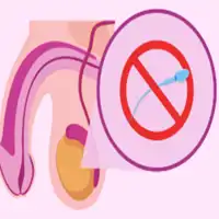 Non-Obstructive Azoospermia Treatment in Lucknow, India