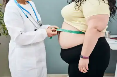 Obesity Homeopathic Treatment in Lucknow, India