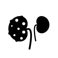 Polycystic Kidney Disease (PKD) Treatment in Lucknow