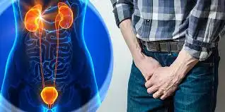 Prostatitis Homeopathic Treatment in Lucknow India