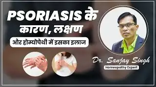 Psoriasis Educational Video, its Symptoms, causes, and Homeopathic Treatment