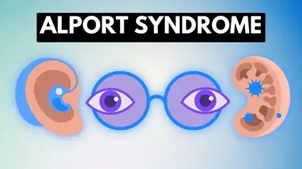 Alport Syndrome Treatment
