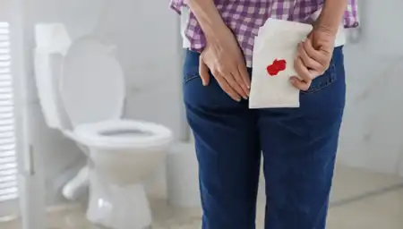 Anal Stenosis Treatment in Lucknow