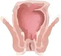 Anal Stenosis