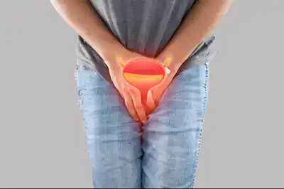 Bladder Stone Homeopathic Treatment in Lucknow India