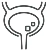 Bladder Stone Treatment in Lucknow India