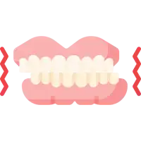 Bruxism (Teeth Grinding)