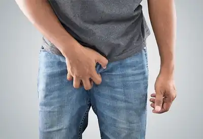 Epididymitis Homeopathic Treatment in Lucknow, India