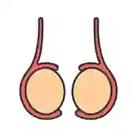 Epididymitis Treatment in Lucknow, India