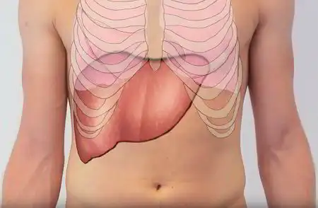 Hepatomegaly Enlarged Liver Homeopathic Treatment in Lucknow India