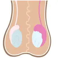 Orchitis Treatment in Lucknow, India