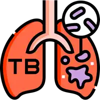 Tuberculosis (TB) treatment in Lucknow India