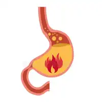 Acid Reflux