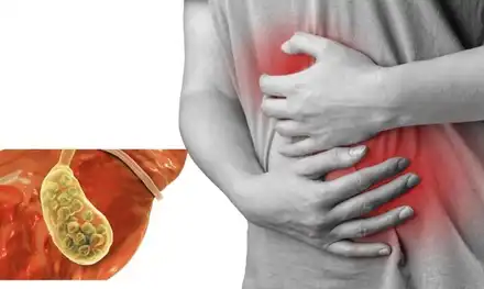 Bile Duct Stones Treatment in Lucknow India