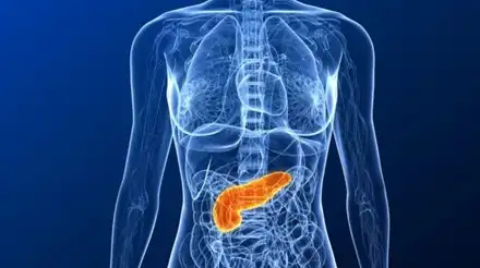 Pancreatitis Treatment in Lucknow India