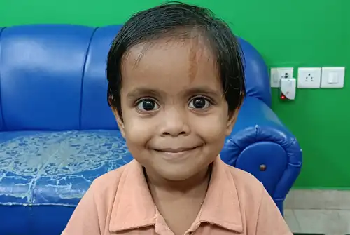 Successful Treatment of Chest Cyst in a Child Without Surgery in Lucknow