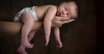 Hypotonia in Children