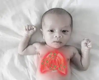 Pneumonia in Children
