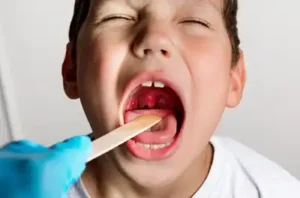 Adenoiditis in Children