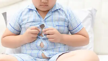 Obesity in Children