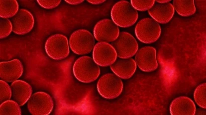 Aplastic Anemia
