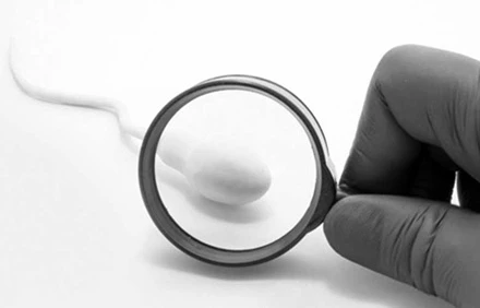 Oligospermia (Low Sperm Count)